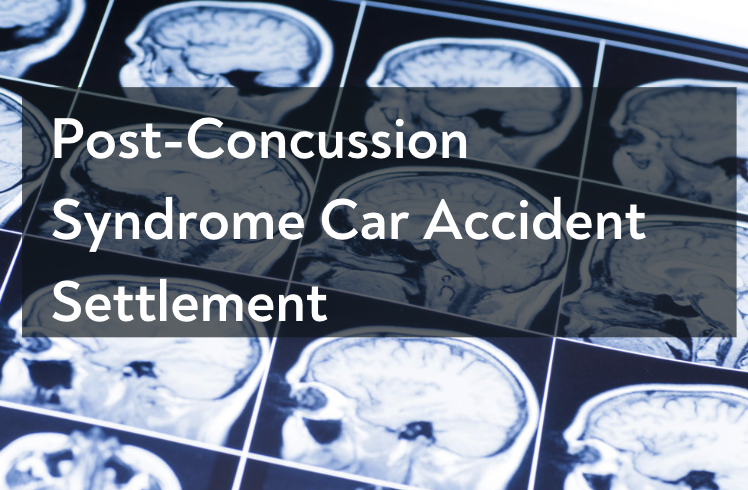 recent-post-concussion-syndrome-car-accident-settlements-in-fl